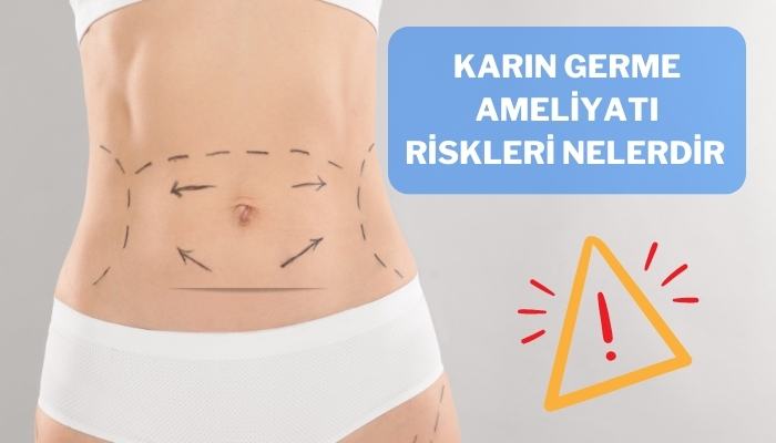 Karın Germe Ameliyatı Riskleri