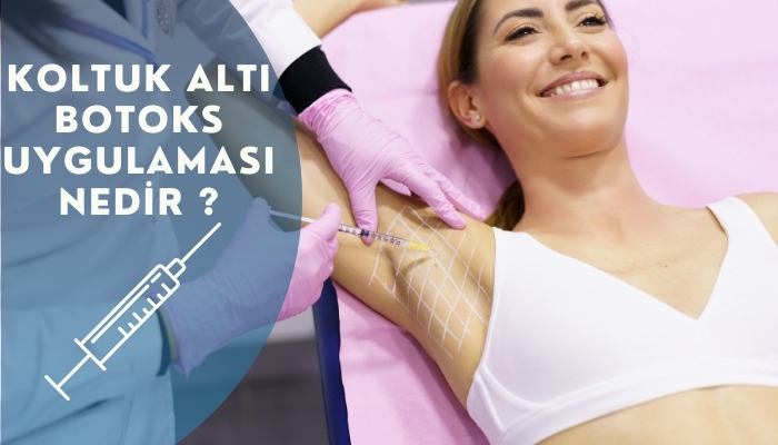 Koltuk Altı Botoks Uygulaması Nedir?