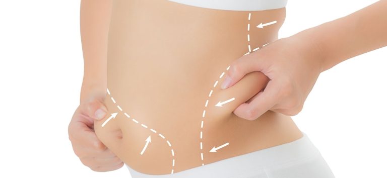 Liposuction Avantajları