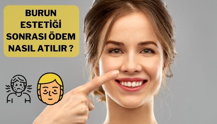 Burun Estetiği Sonrası Ödem Nasıl Atılır ?