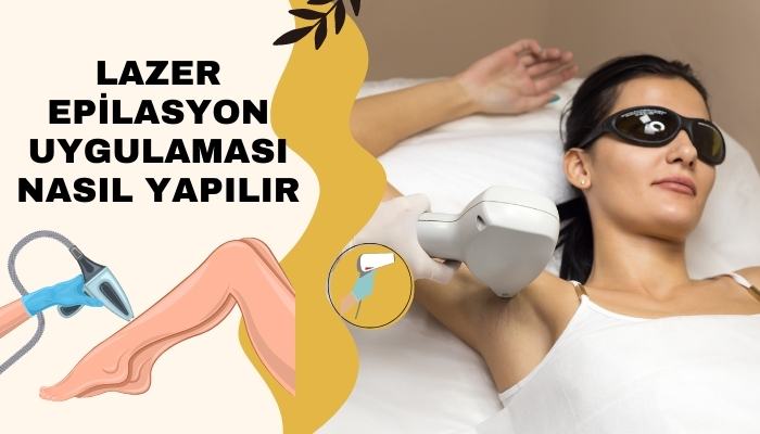 Lazer Epilasyon Uygulaması Nedir ? Nasıl Yapılır?