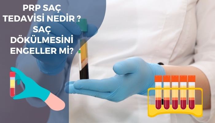 PRP Saç Tedavisi Nasıl Yapılır ? Saç Dökülmesine Son