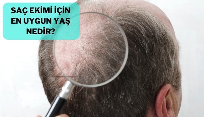 Saç Ekimi İçin En Uygun Yaş Nedir