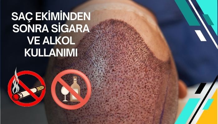 Saç Ekiminden Sonra Sigara ve Alkol Kullanımının Riskleri