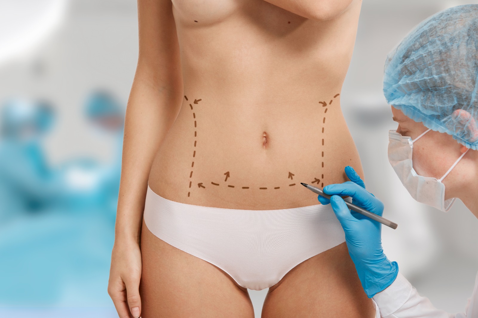 Vaser Liposuction Nedir? Nasıl Uygulanır?